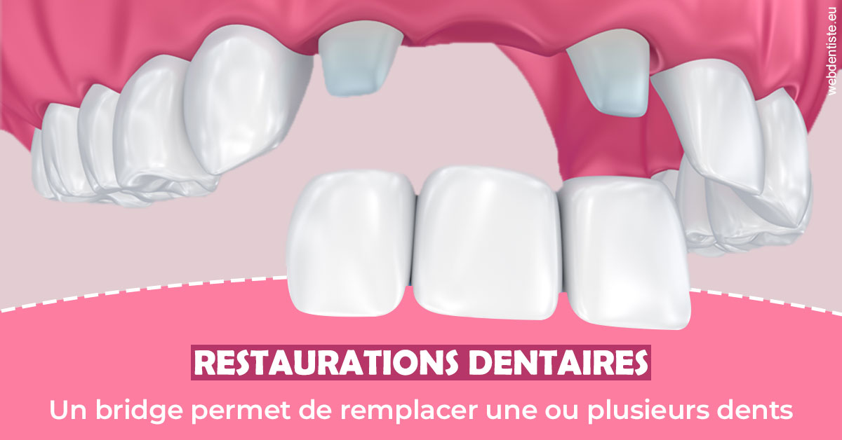 https://dr-hassaneyn-allemand.test-moncomptewebdentiste.fr/Bridge remplacer dents 2