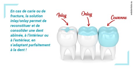 https://dr-hassaneyn-allemand.test-moncomptewebdentiste.fr/L'INLAY ou l'ONLAY