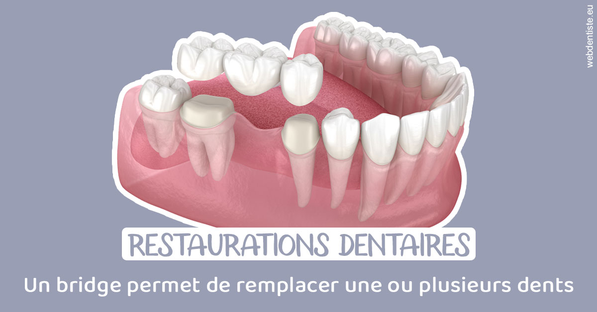 https://dr-hassaneyn-allemand.test-moncomptewebdentiste.fr/Bridge remplacer dents 1